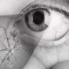 Retinopati Diabetik